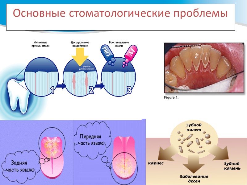 Основные стоматологические проблемы